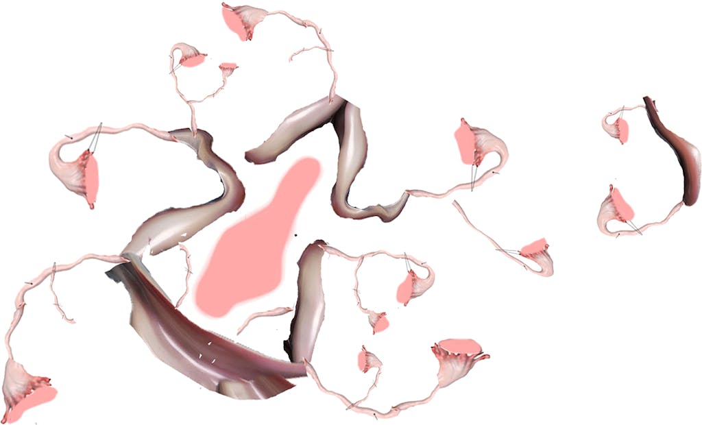 Æggestok - Anna-Aagaard-Jensen