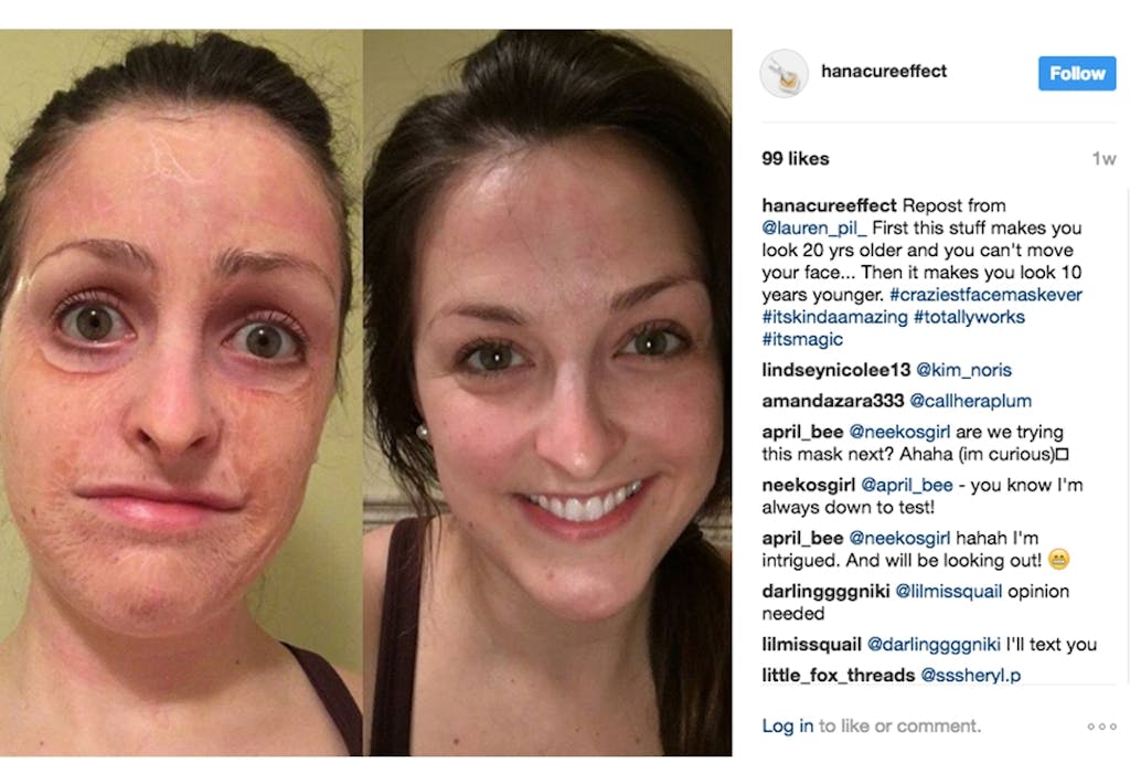 The Hanacure: før og etter bruk av ansiktsmasken