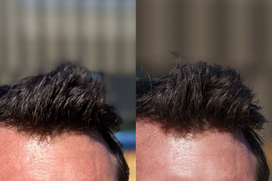 Sammenligning av bilde fra telefon og bilde fra kamera.