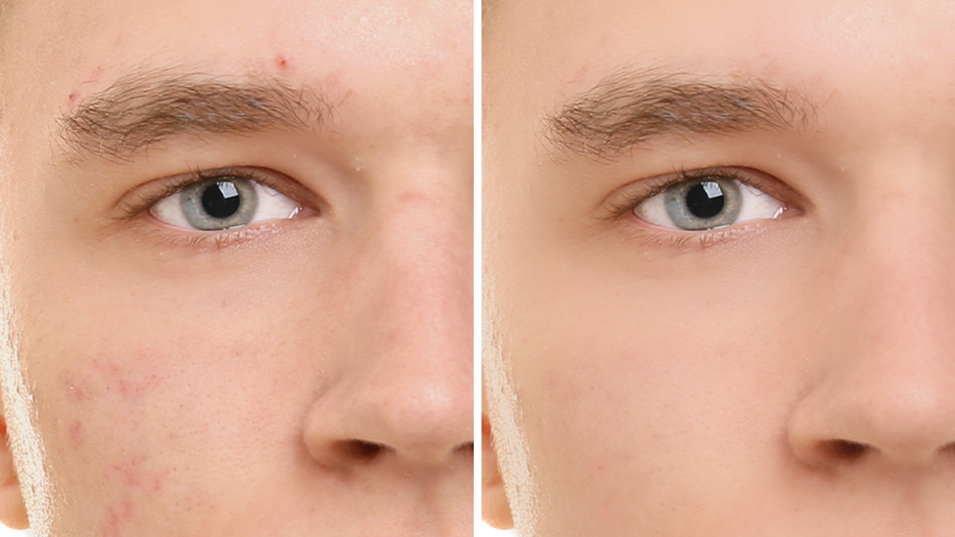 Här är huden utjämnad med hjälp av Photoshop Elements.