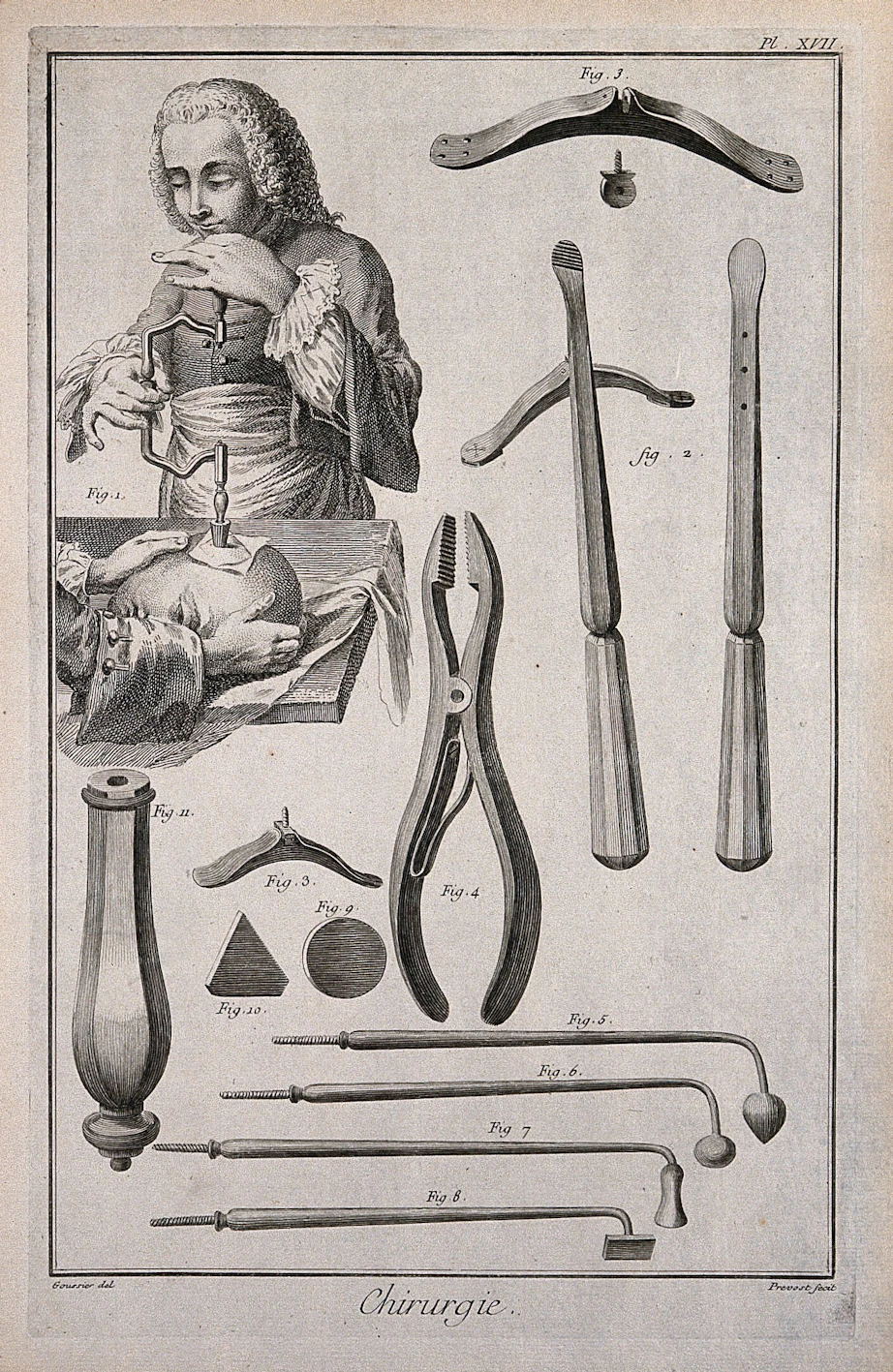 Sten lderm nniskor Levde Med H l I Huvudet Varldenshistoria se sten-lderm-nniskor-levde-med-h-l-i-huvudet-varldenshistoria-se