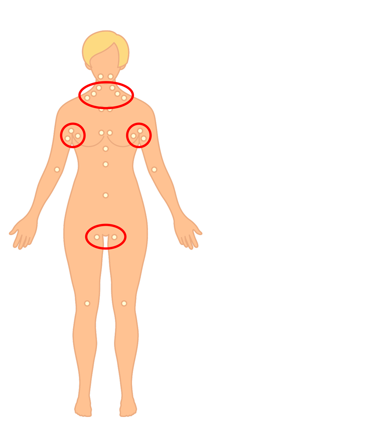 Lymfeknuder – her kan du tjekke for kræft, hævede lymfekirtler