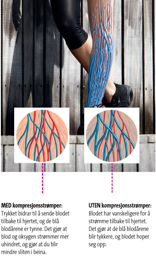 Slik påvirker kompresjonsstrømper blodomløpet i beina. 