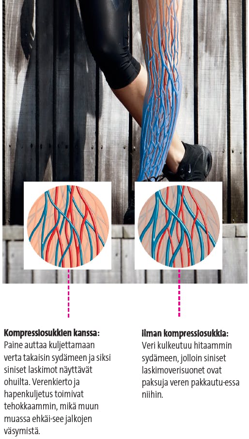 Näin kompressiosukat vaikuttavat jalkojen verenkiertoon.