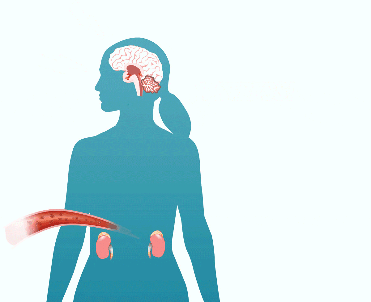 Elimistön kortisolintuotanto