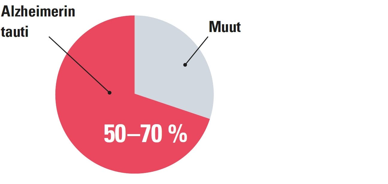Alzheimerin tauti on yleisin muistisairaus