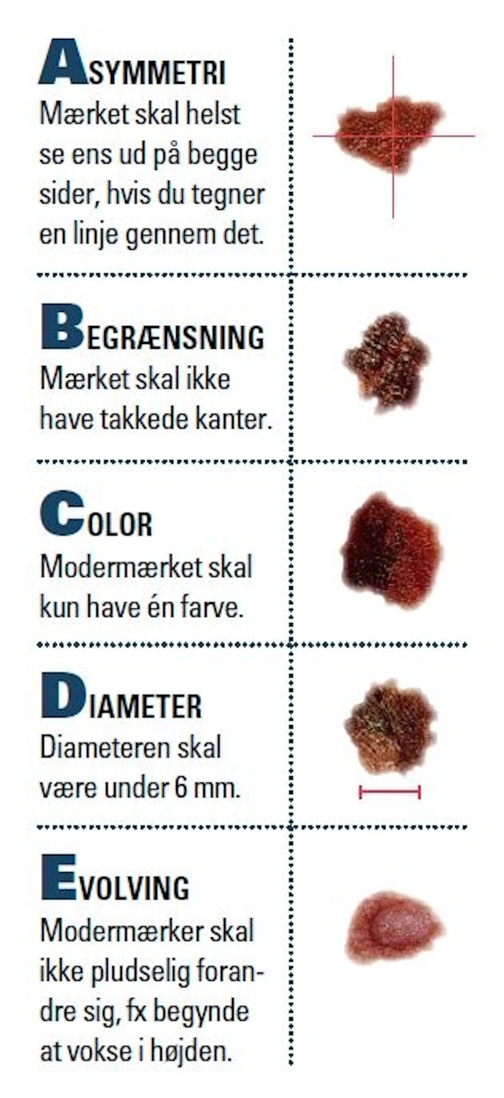 Moderm rkekr ft Hvad Er Symptomerne I FORM