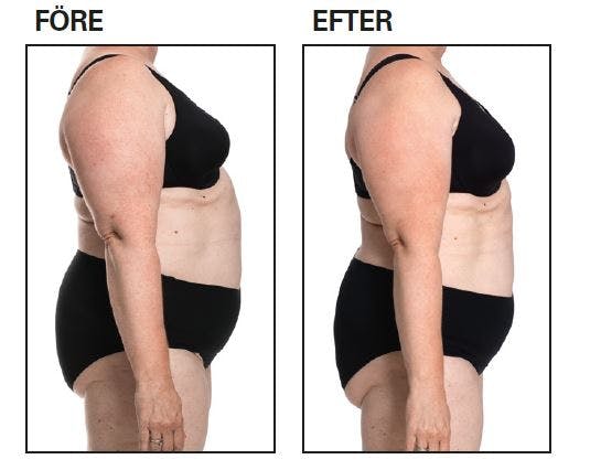 Före- och efterbilder från 8-timmarsdieten