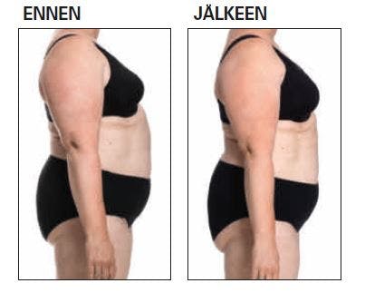 Pätkäpaasto: ennen- ja jälkeen-kuvat