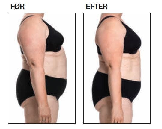 Før-efter-billeder fra 8-timerskuren