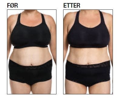 Før-etter-bilder fra sensekuren