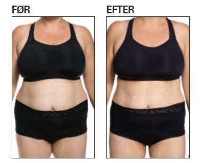 Før-efter-billeder fra Sense-kuren