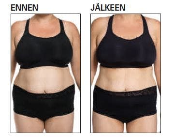 Kouramenetelmä: ennen- ja jälkeen-kuvat