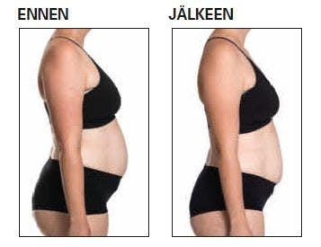 Treenibootcampin vaikutukset ennen- ja jälkeen-kuvissa.