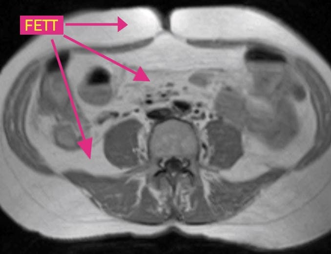 For mye mellom innvollene