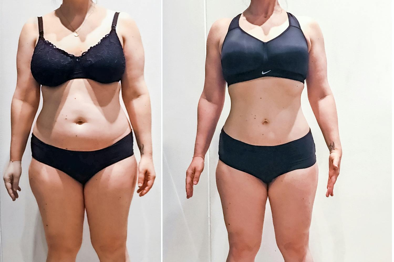 Line, 35 år, blev av med valkarna på magen