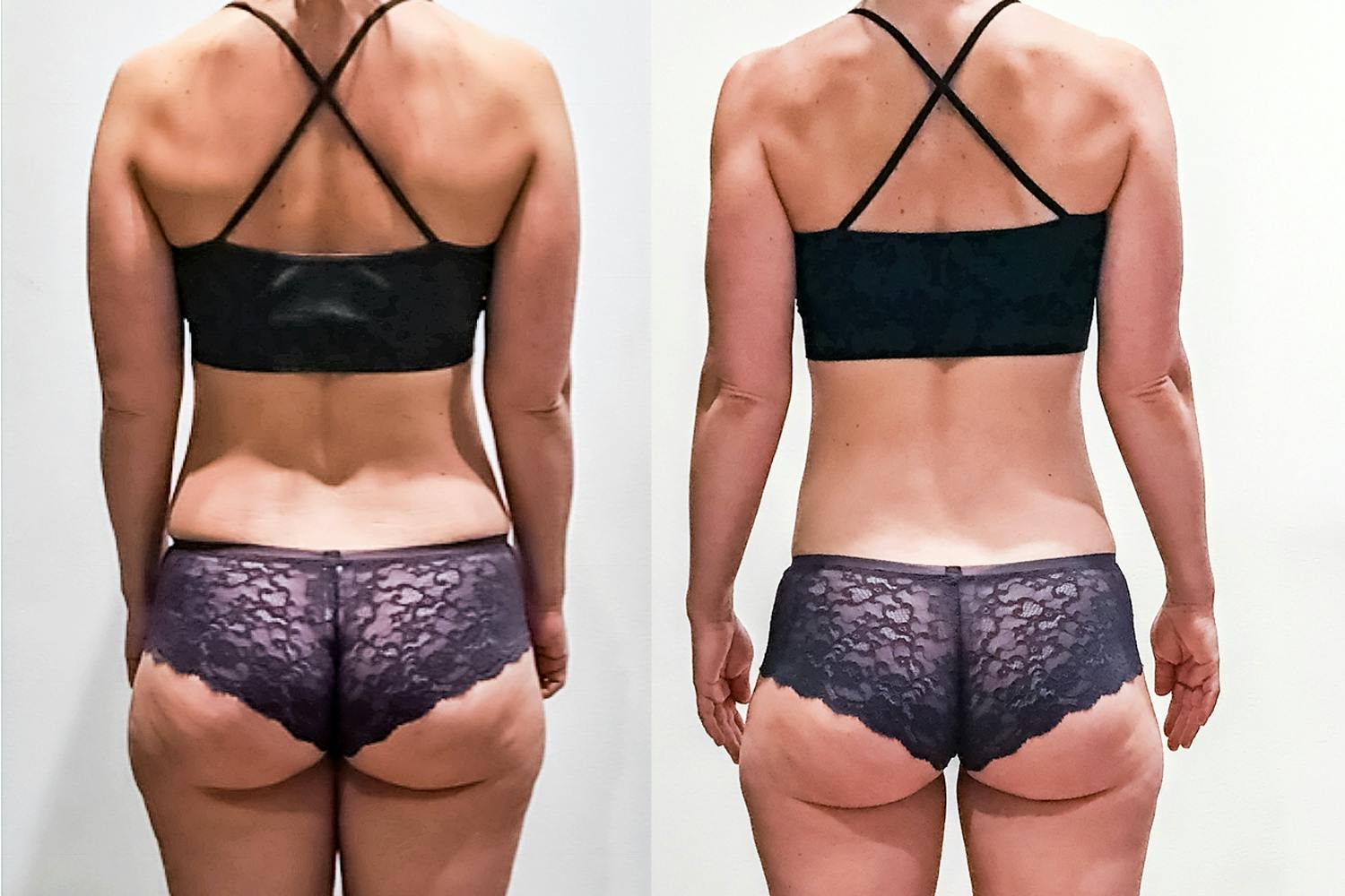 Freja på 33 år smed 9 cm om hofterme