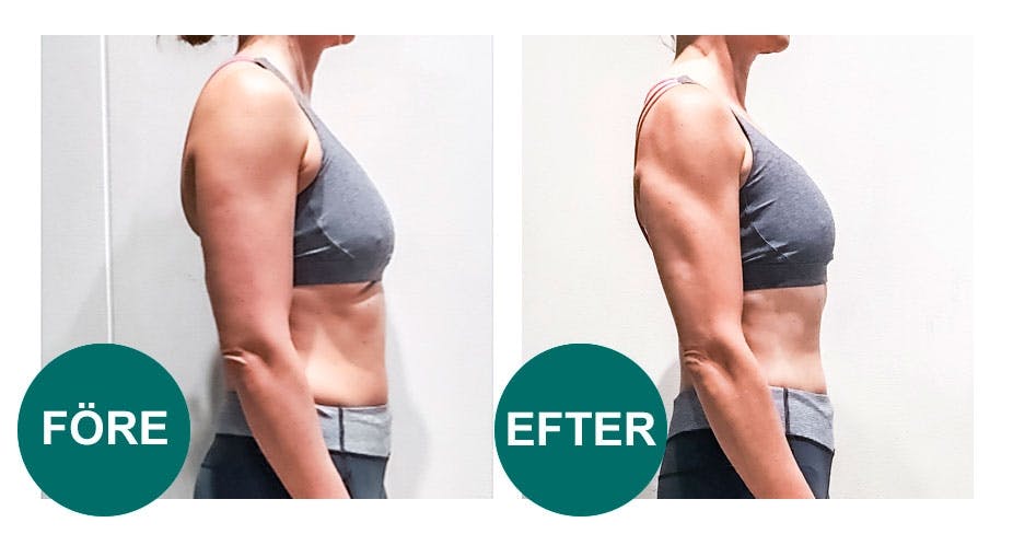 Före- och efterbilder på armar