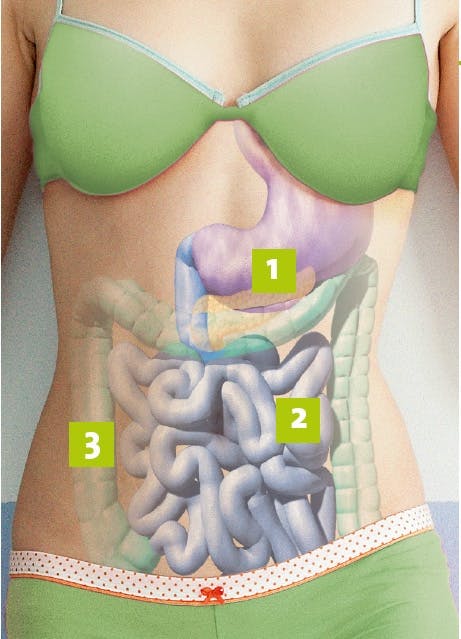 billede af forstoppelse i tarmene