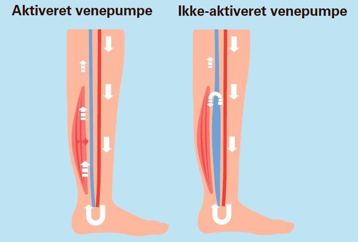 Venpumpe