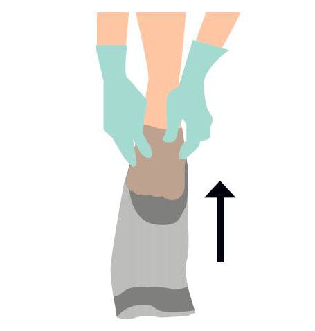 step 1 sådan bruger man kompressionsstrømper