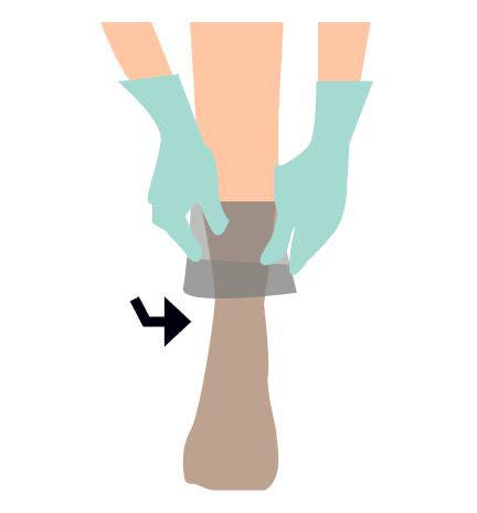 step 2 kompressionsstrømper