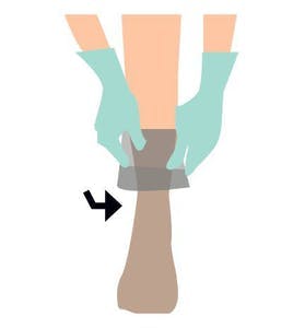 steg 2 kompresjonsstrømper