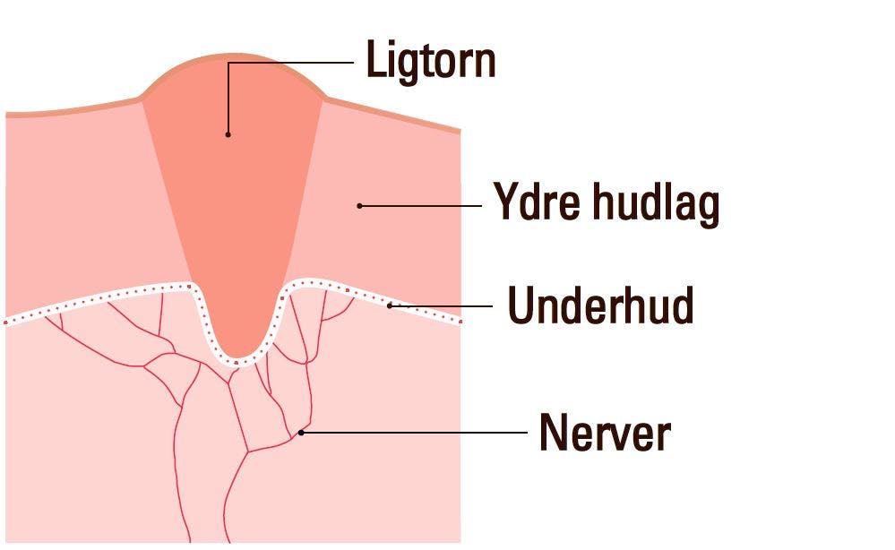 Illustration af ligtorn