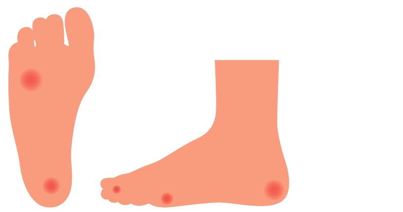 Placering av liktornar