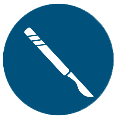 Jalkapohjan syylän raaputus