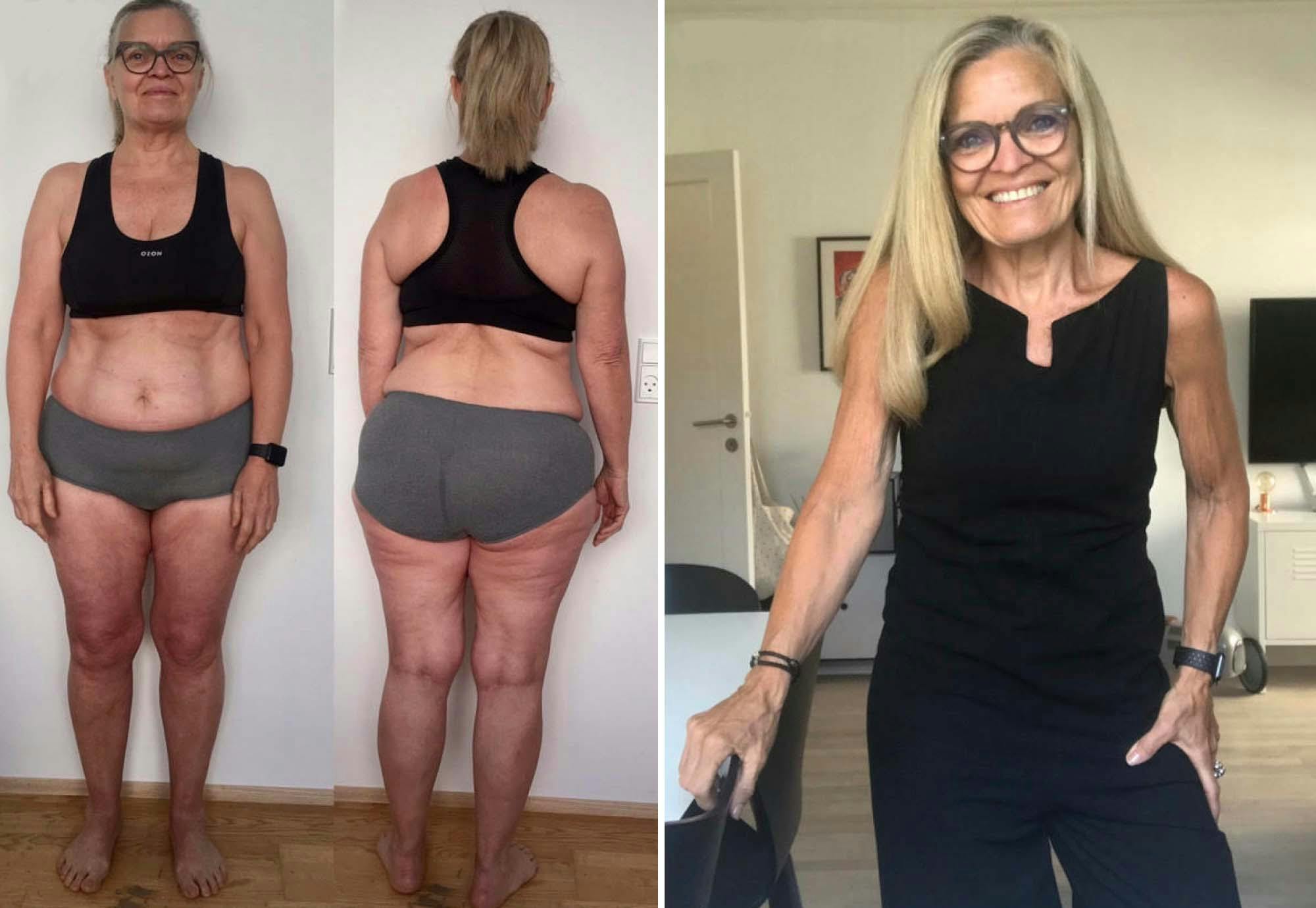 Lise, 66 år Före- och efterbilder av kvinna i 60-årsåldern som har gått ner i vikt.