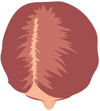 Hårtab - stressfremkaldt