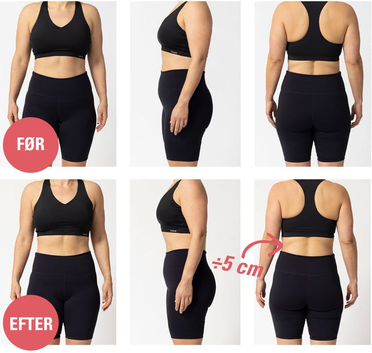 Anne testede 5:2-kur – før og efter-billeder