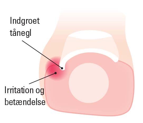 Nedgroet negl grafik