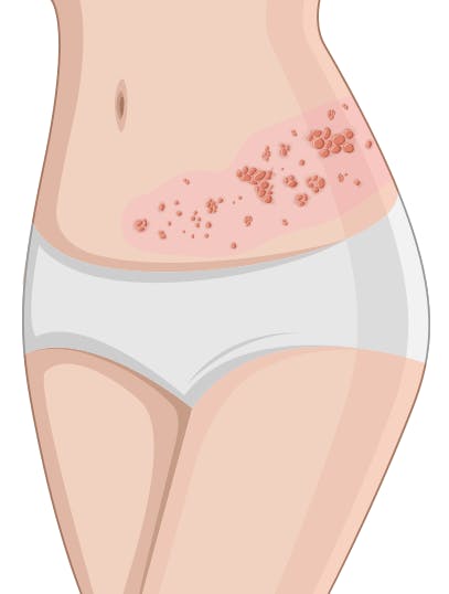 Helvetesild-kropp-grafikk