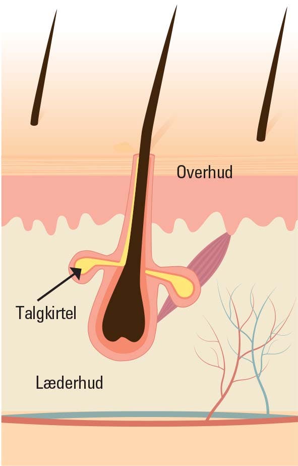 Tør-hovedbund-illustration