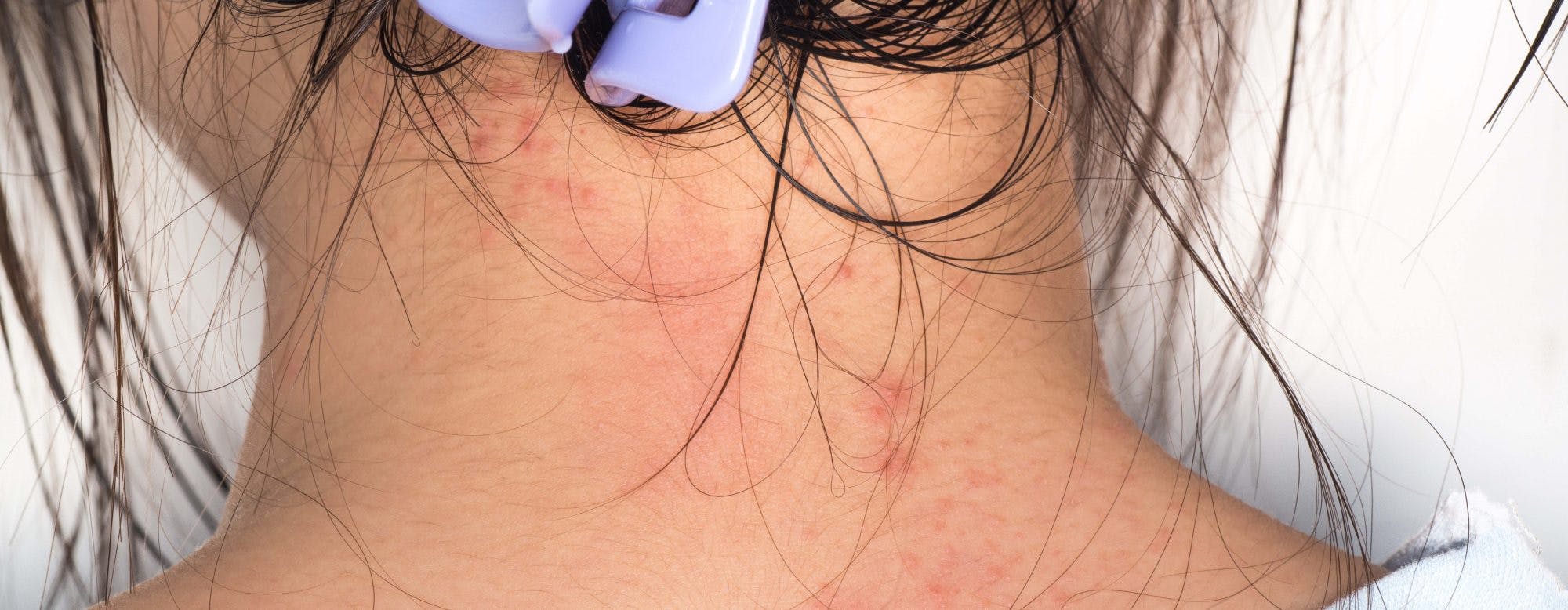 Undgå at komme hårpro­dukter helt ned i hovedbun­den.