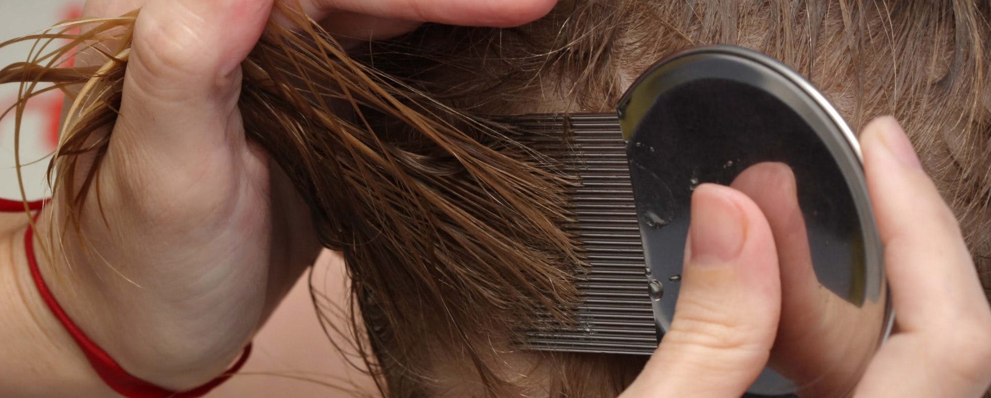 Er det lus, der har fået hår­ bunden til at klø, kan du gå til modangreb med disse råd