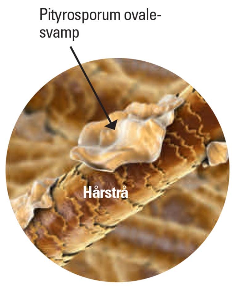 Pityrosporum ovale-svampen