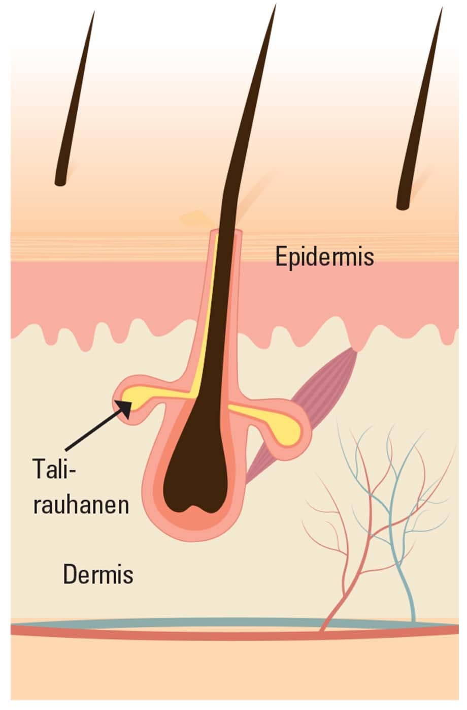 Miksi päänahan iho kuivuu?