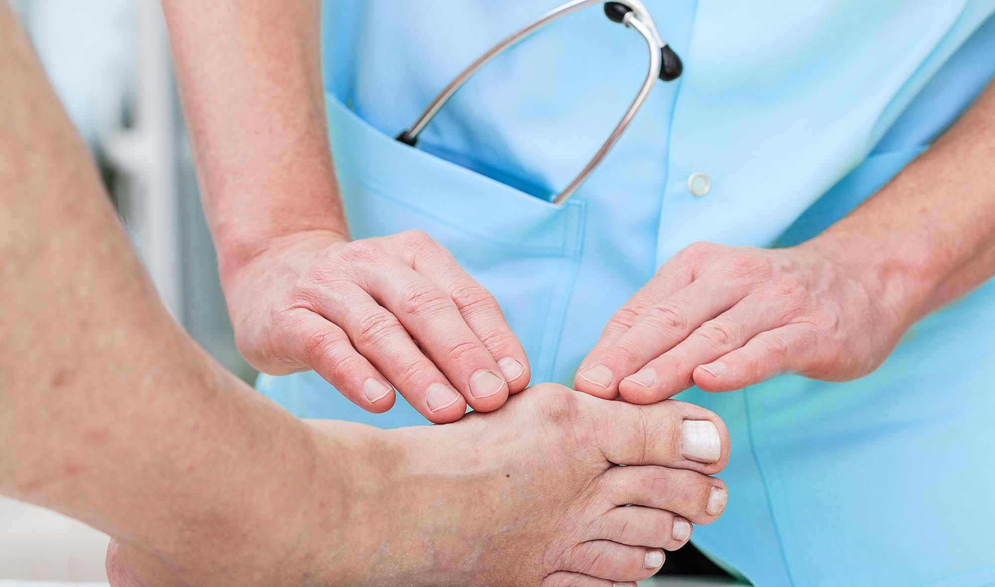 Lääkäri arvioi tarvitsevatko vaivaisenluut leikkausta