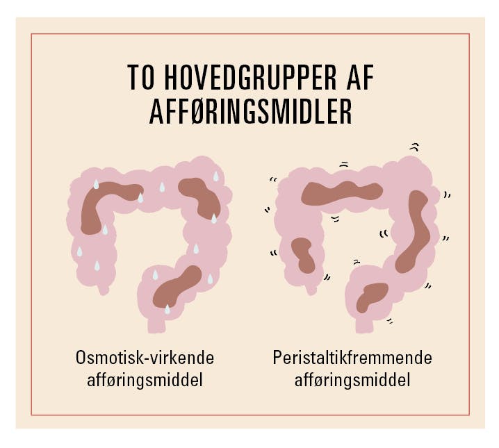 Illustration af afføringsmiddel, osmotisk og peristaltik-fremmende