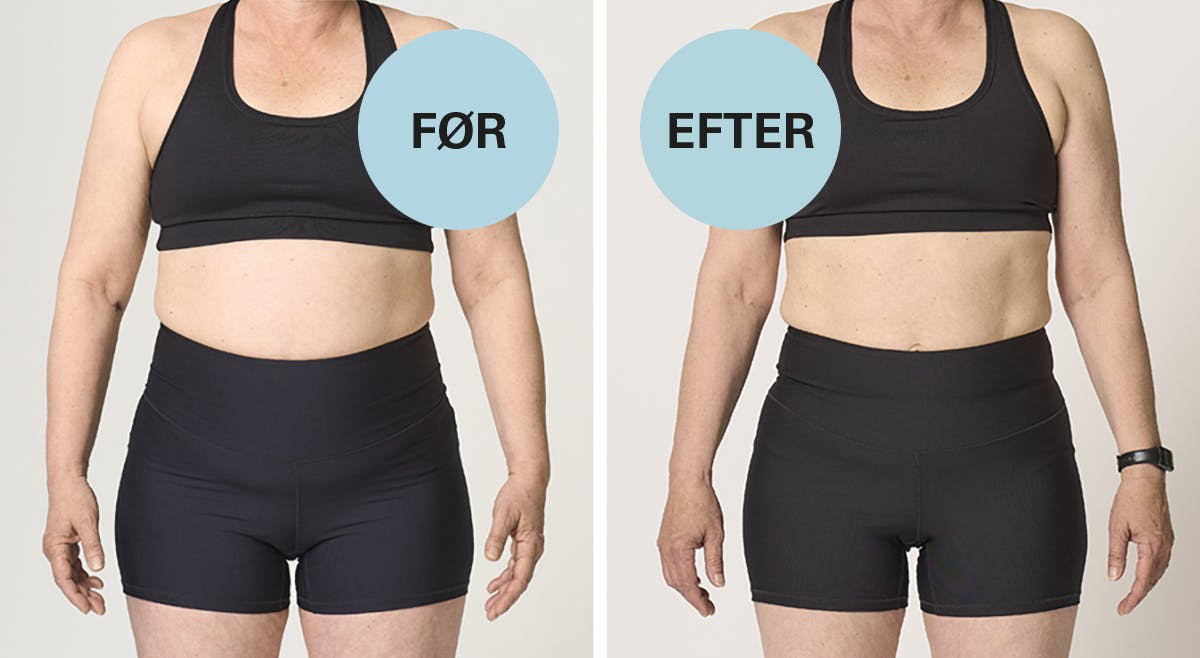 Før og efter-foto af Ann Lena