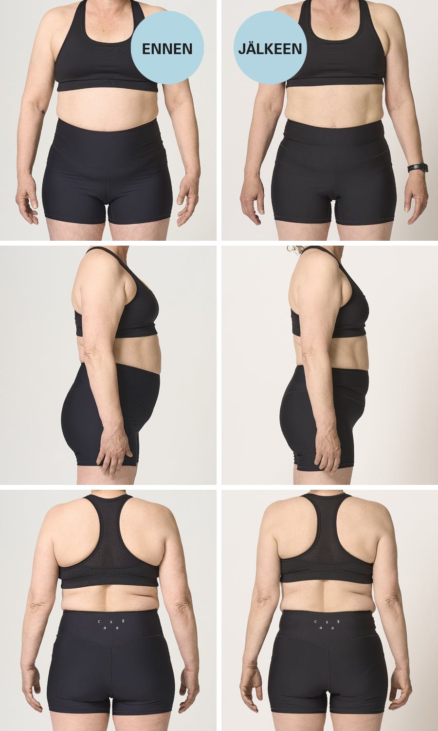 Ann Lena ennen ja jälkeen; edestä, takaa ja sivulta