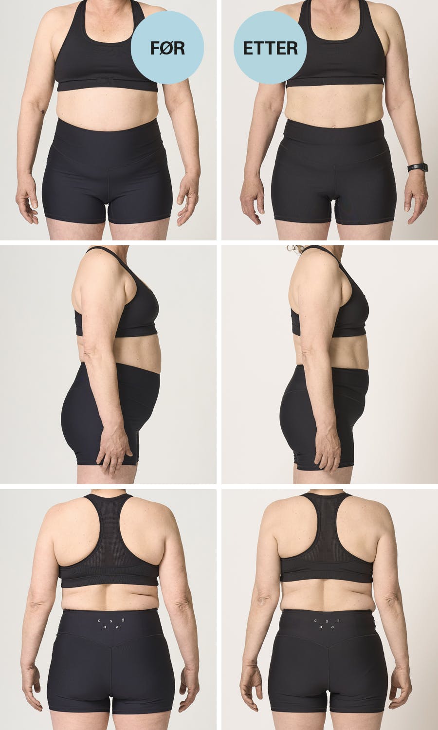 Før- og etterbilder av Ann Lena – forfra, bakfra og fra siden