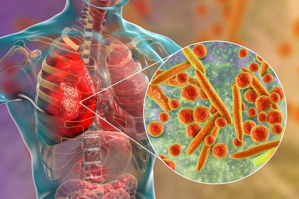 Grafisk fremstilling av bakterien mycoplasma pneumoniae som forårsaker atypisk lungebetennelse.
