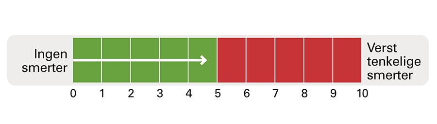 Smertebarometer illustrasjon