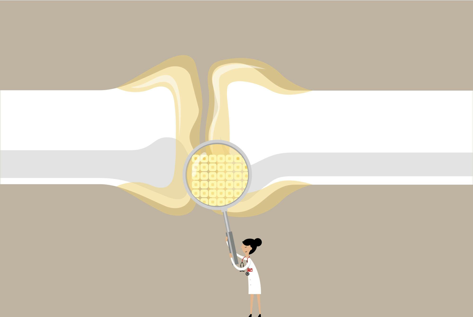 Grafik af knogle og lup, der kigger på bindevæv