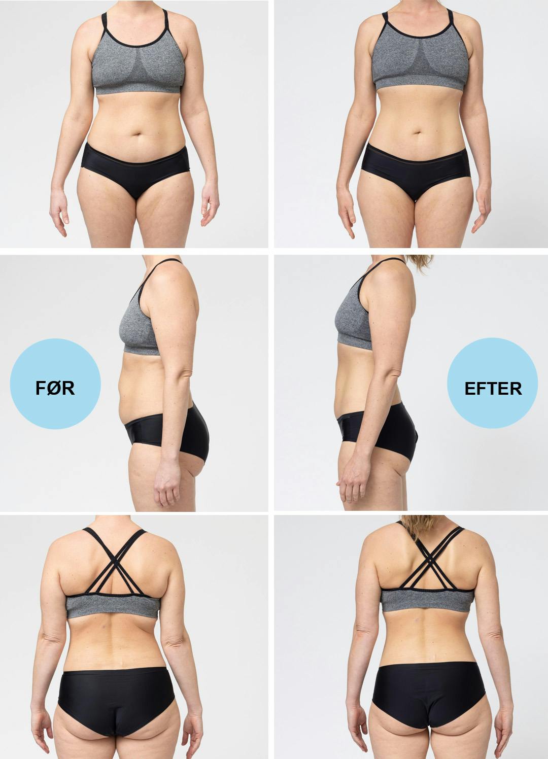 Før efter side by side case Christina.