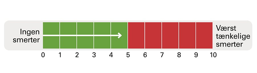 Smertebarometer illustration